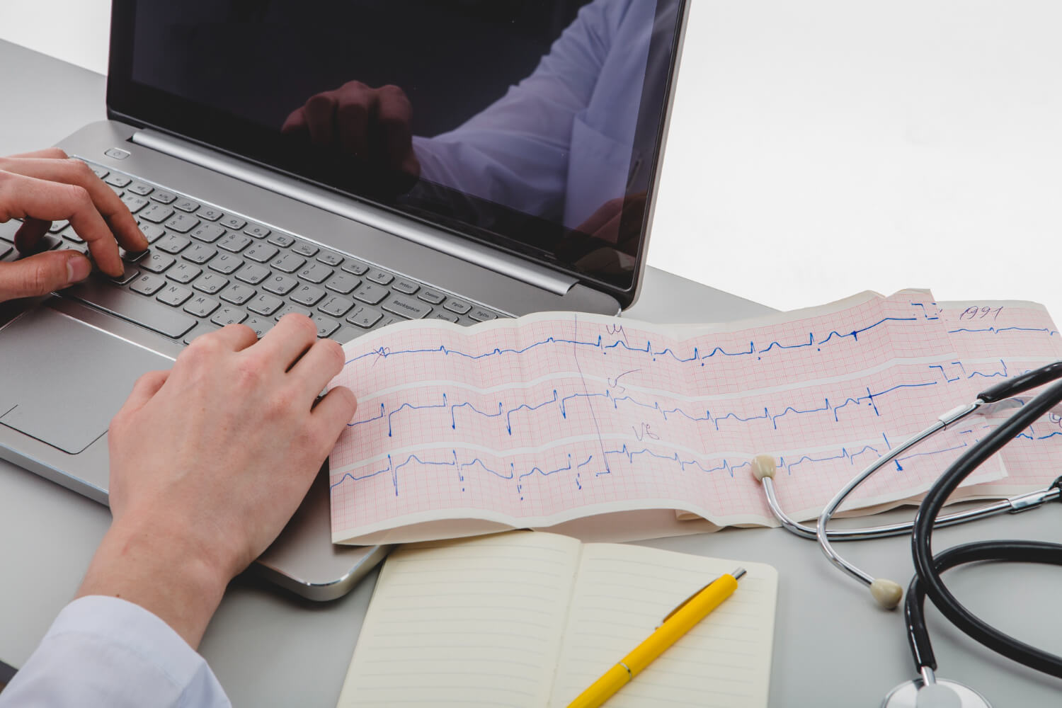 Ekg vizsgálat